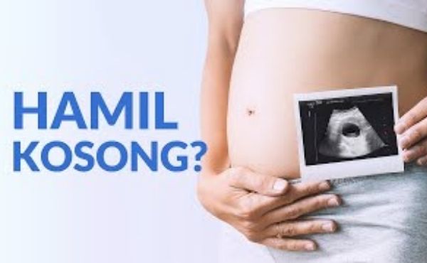 Apa yang dimaksud dengan Kehamilan kosong?